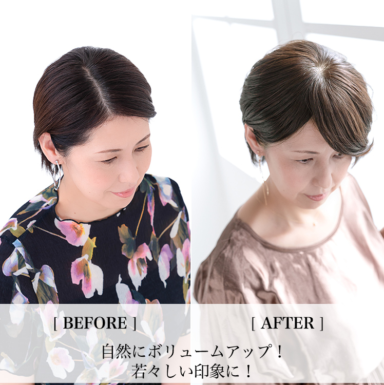 アクアドールのヘアピース「総手植え人毛MIX6分ウィッグ リアルスキン ナチュラルストレート」のトップ部分ビフォーアフター
