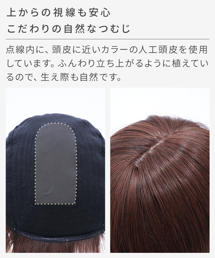 肌色の人工頭皮で自然なつむじの見た目を実現しています。