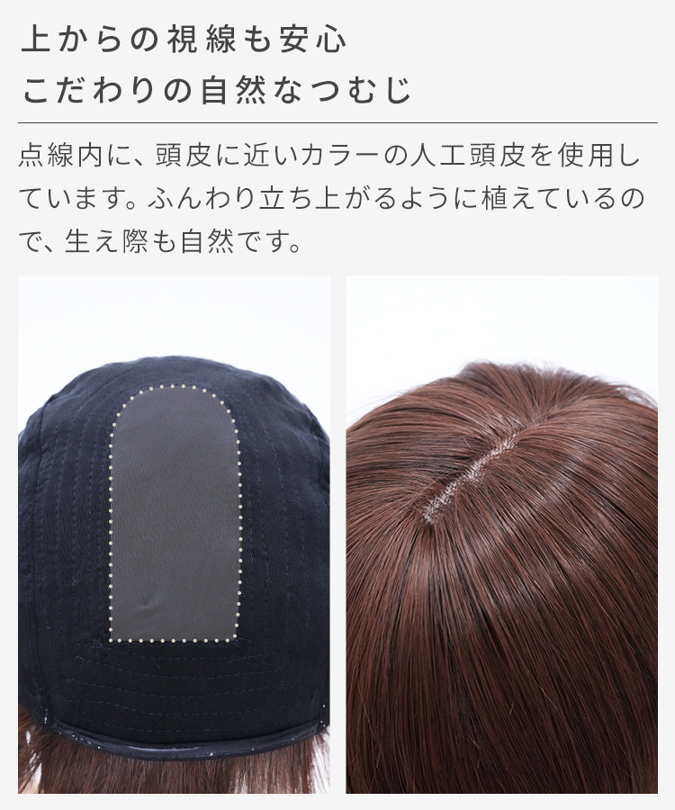 肌色の人工頭皮で自然なつむじの見た目を実現しています。