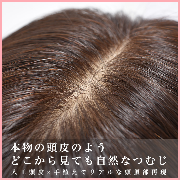 つむじ部分には、頭皮の見た目をリアルに再現する業界最先端の非常に自然な素材「人工頭皮」を使用しており植えた毛の根元が見えなくなったため、見た目が非常に自然です。