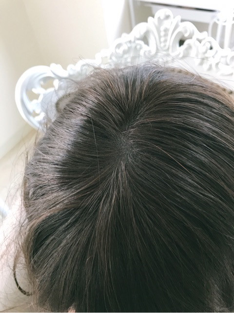 つむじ アクアドールヴィーナスのつむじはスキンネットだからつむじがリアル