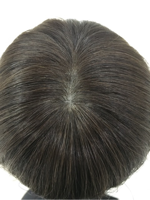 ストレスでの脱毛でお悩みの方へ！ヘアピースウィッグはいかが？