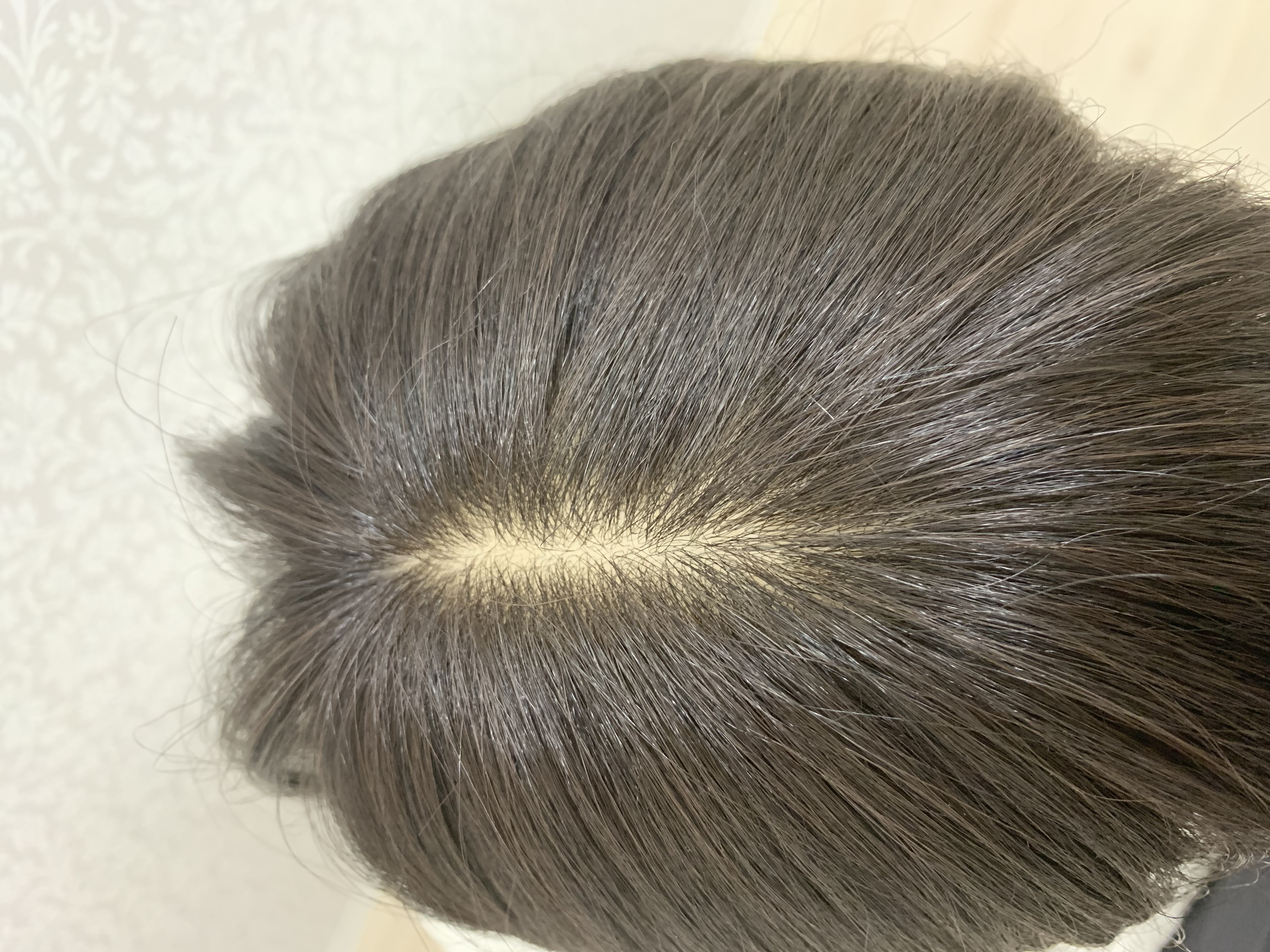 人工皮膚ついてます