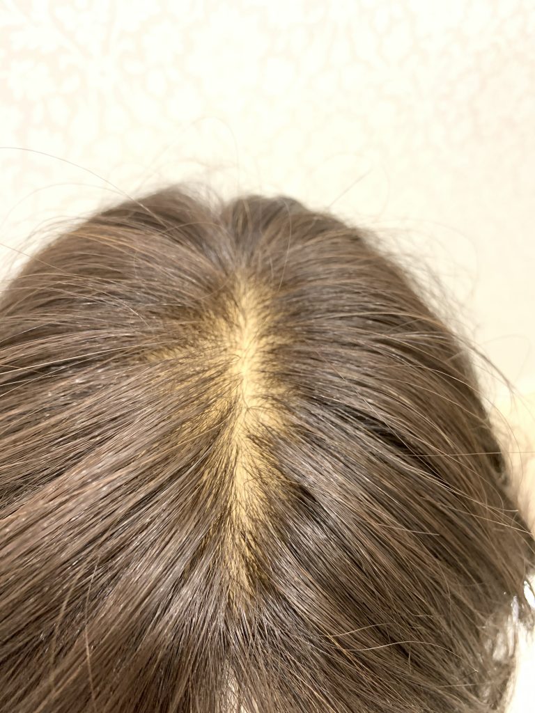 人工皮膚付き