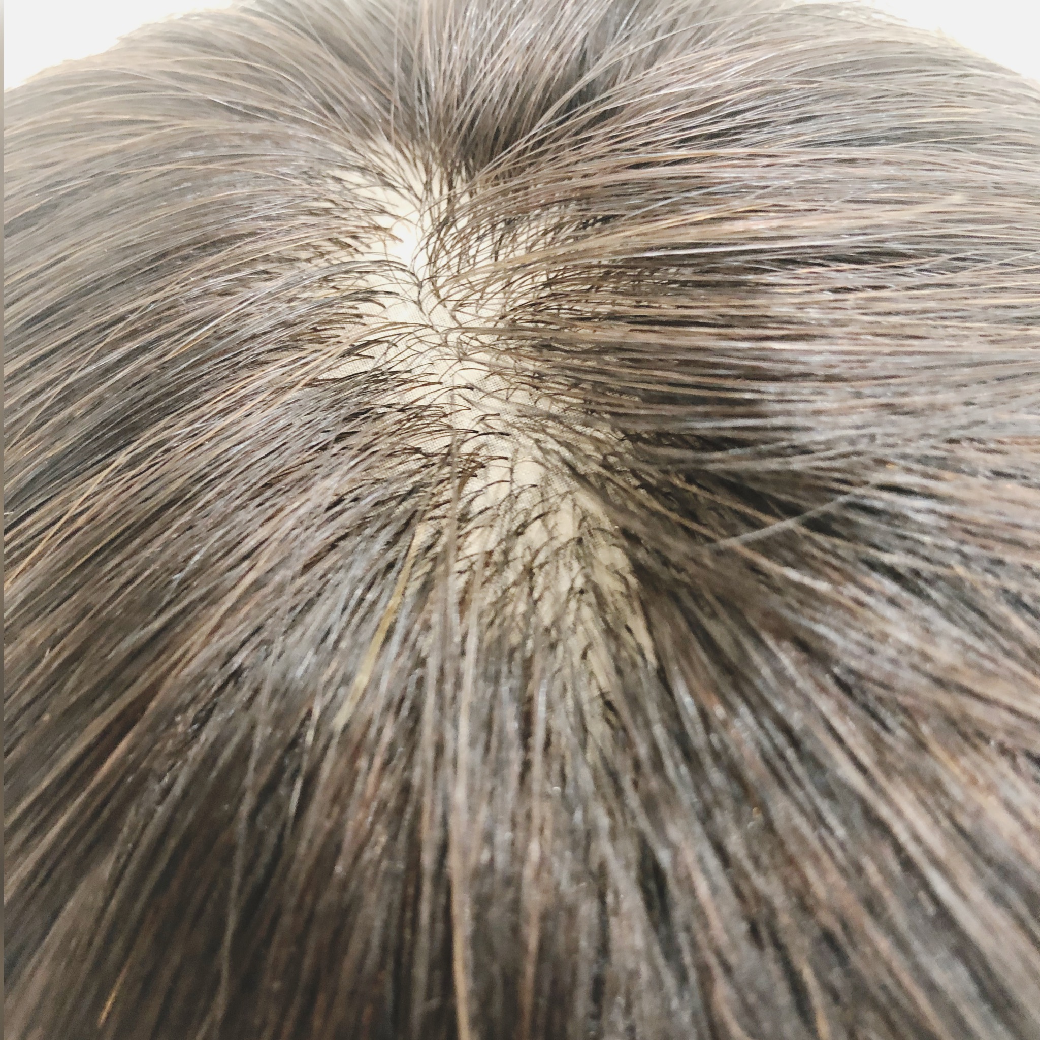 人毛100％の自然なヘアピース | 札幌サロン公式ブログ| 自然なウィッグ